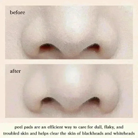 Korean Skincare NOONI Daily Turnover Peel Pads ~145ml (80 count) ~ NEW in box! - Picture 6 of 7